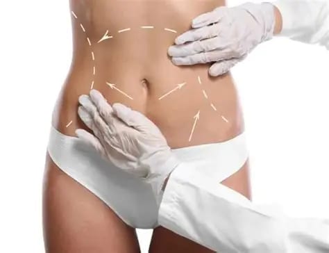 3D Lipo Cavitation