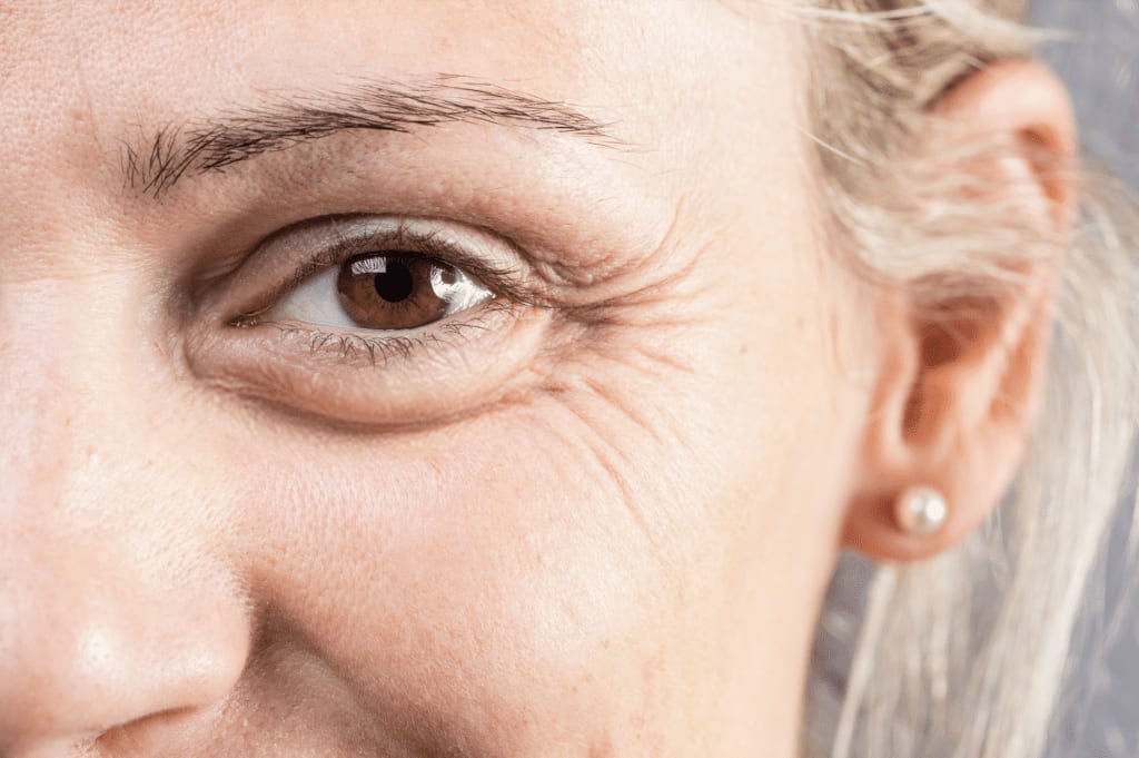 Anti-Wrinkle Injections